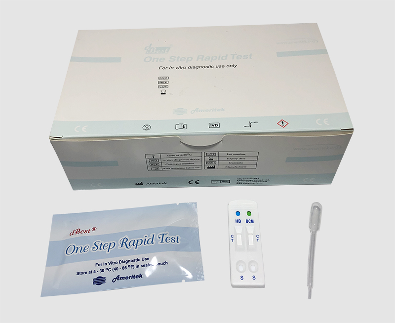 Bladder infection test